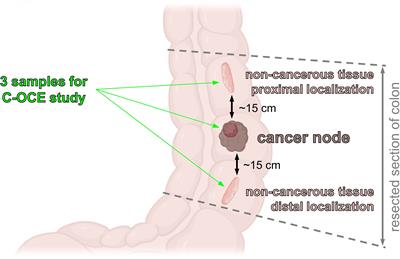 Frontiers Towards Targeted Colorectal Cancer Biopsy Based On Tissue